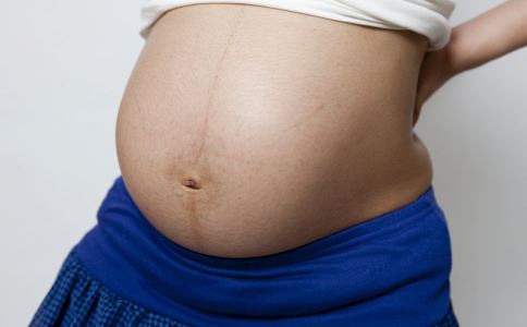 孕晚期妊娠纹 孕晚期妊娠纹痒怎么办 如何预防祛除妊娠纹
