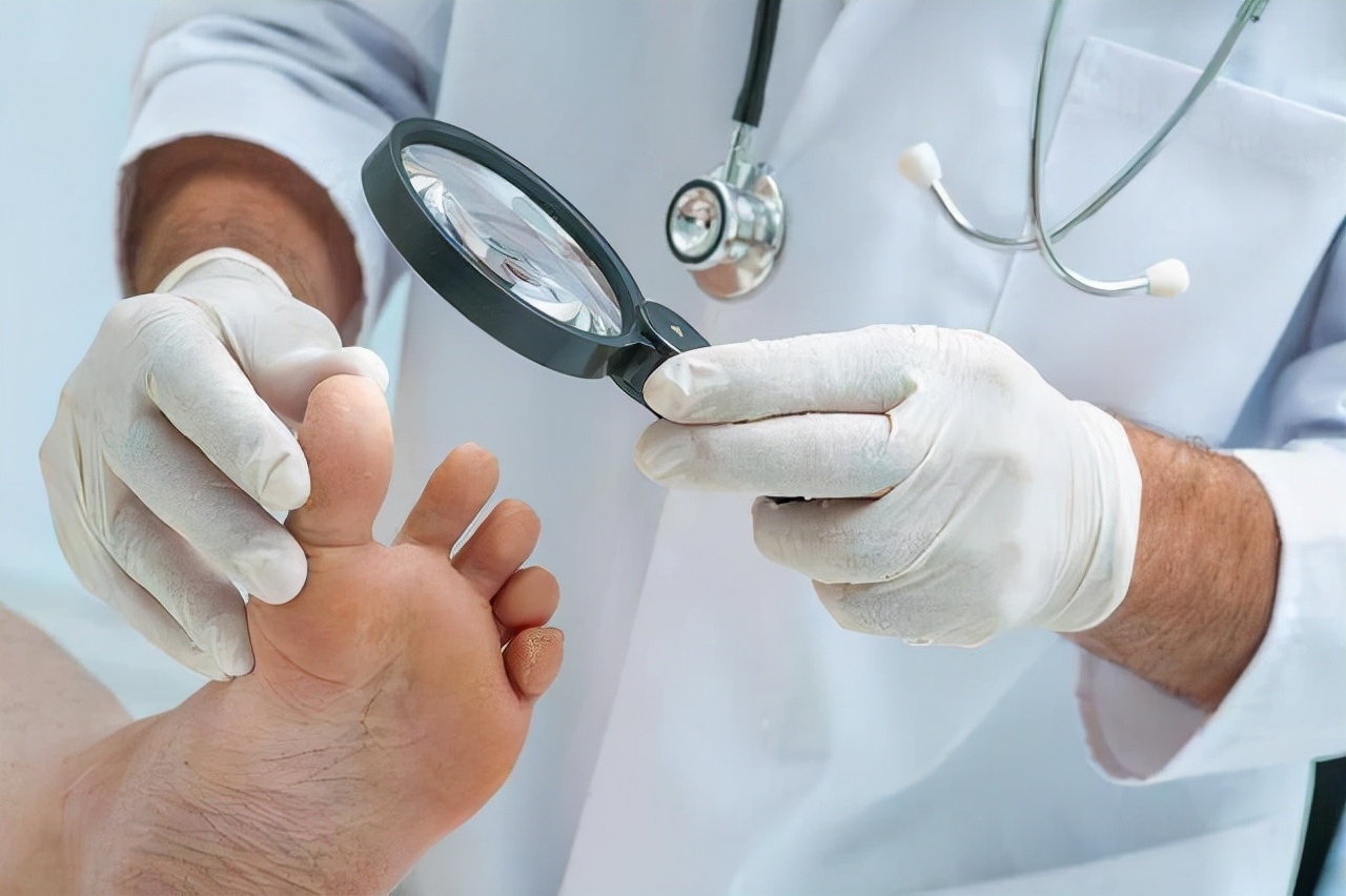 血糖超标，“脚”会提醒？医生：若出现这5种症状，早做检查为好